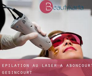 Épilation au laser à Aboncourt-Gesincourt