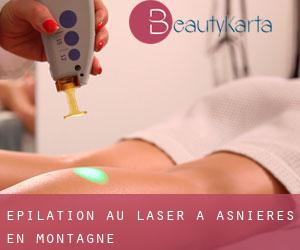 Épilation au laser à Asnières-en-Montagne