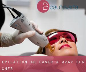 Épilation au laser à Azay-sur-Cher