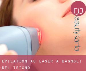 Épilation au laser à Bagnoli del Trigno