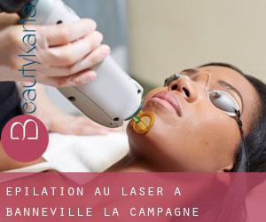 Épilation au laser à Banneville-la-Campagne