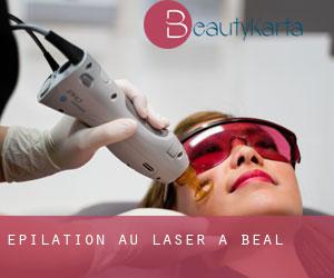 Épilation au laser à Beal