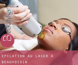 Épilation au laser à Beauvoisin