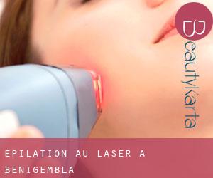 Épilation au laser à Benigembla