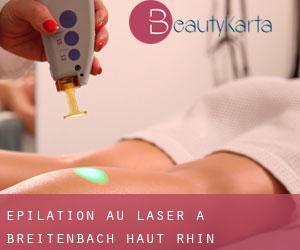 Épilation au laser à Breitenbach-Haut-Rhin