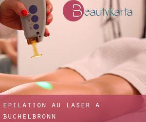 Épilation au laser à Büchelbronn