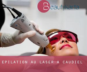 Épilation au laser à Caudiel