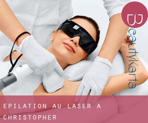 Épilation au laser à Christopher