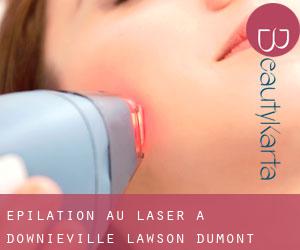 Épilation au laser à Downieville-Lawson-Dumont