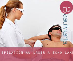 Épilation au laser à Echo Lake