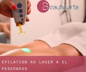 Épilation au laser à El Pedernoso