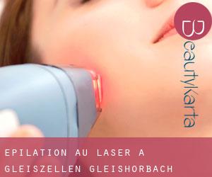 Épilation au laser à Gleiszellen-Gleishorbach