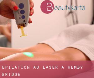 Épilation au laser à Hemby Bridge