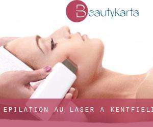 Épilation au laser à Kentfield