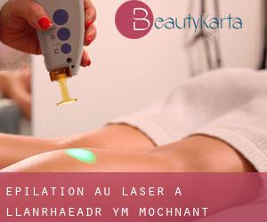 Épilation au laser à Llanrhaeadr-ym-Mochnant