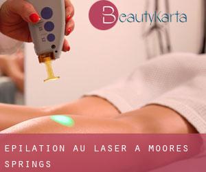 Épilation au laser à Moores Springs