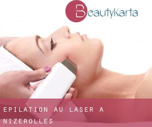 Épilation au laser à Nizerolles