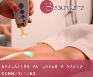 Épilation au laser à Paako Communities