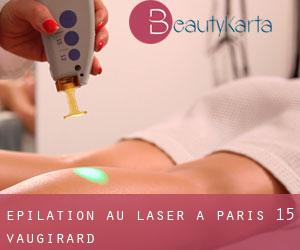 Épilation au laser à Paris 15 Vaugirard
