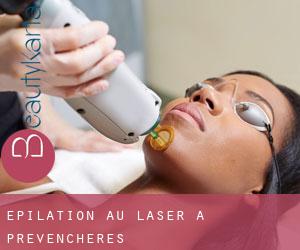 Épilation au laser à Prévenchères