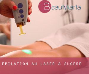 Épilation au laser à Sugère