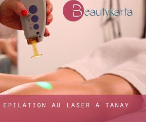 Épilation au laser à Tanay