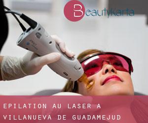 Épilation au laser à Villanueva de Guadamejud