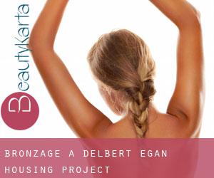 Bronzage à Delbert Egan Housing Project